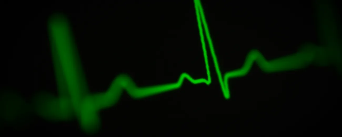 ekg trace